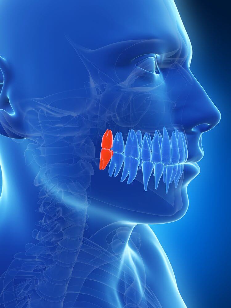 A computer generated image of what wisdom teeth look like in the mouth